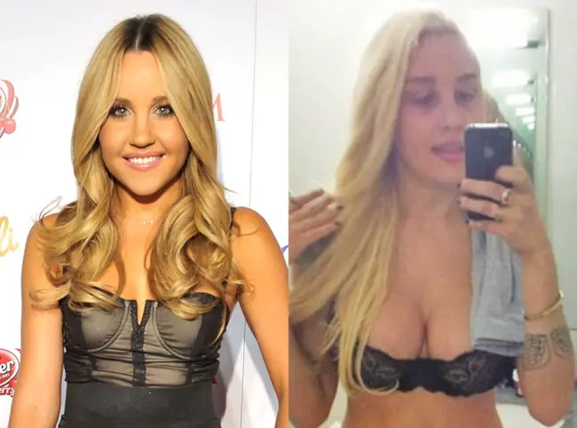 Amanda Bynes Breast Implants Plastic Surgery Before and After