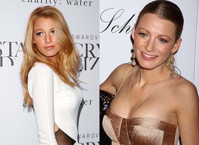 Blake Lively Breast Implants Plastic Surgery Before and After.