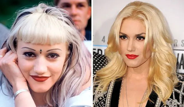 Gwen Stefani Nose Job Plastic Surgery Before and After