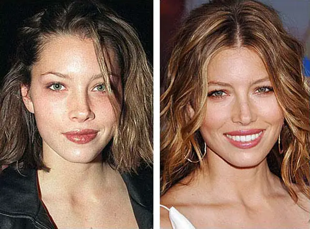 Jessica Biel Plastic Surgery Before and After