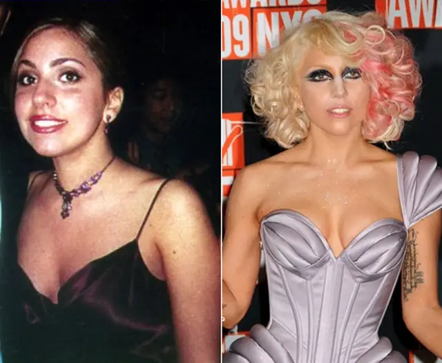 Lady Gaga Plastic Surgery Before and After