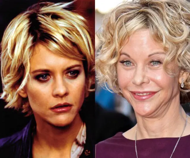 Meg Ryan Plastic Surgery Before and After Celebie