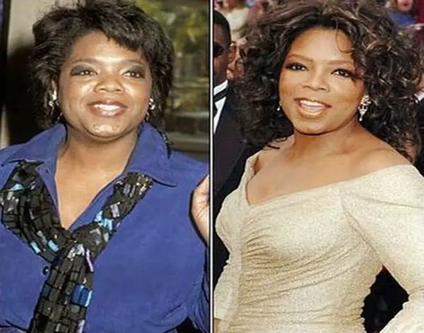 Oprah Winfrey Plastic Surgery Before and After