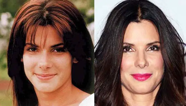 Sandra Bullock Plastic Surgery Before And After