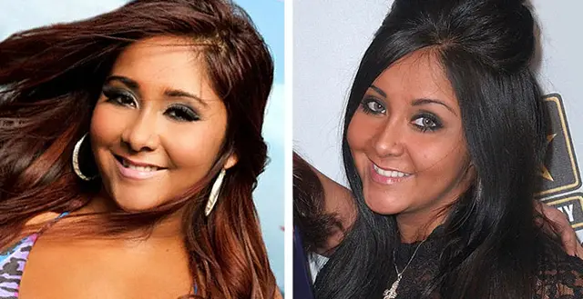 Snooki Plastic Surgery Before and After