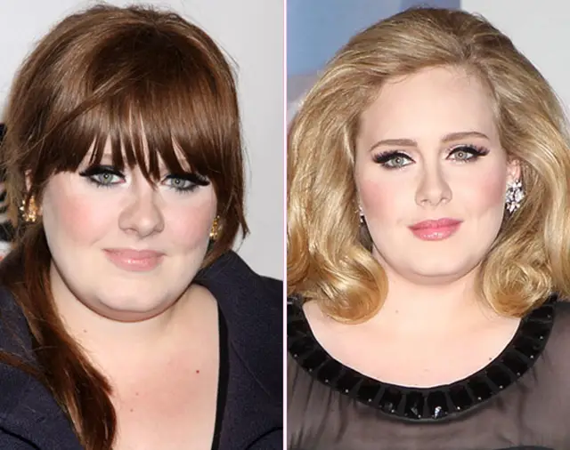 Adele Nose Job Plastic Surgery Before and After
