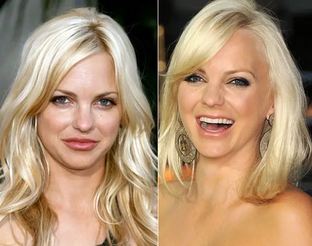 Anna Faris Nose Job