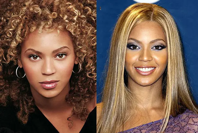 Beyonce Nose Job Plastic Surgery Before and After