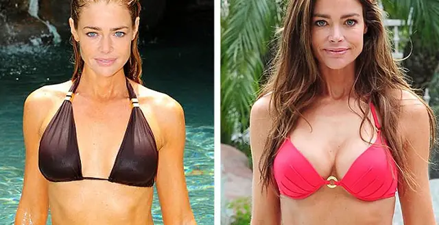 Denise Richards Breast Implants Plastic Surgery Before and After