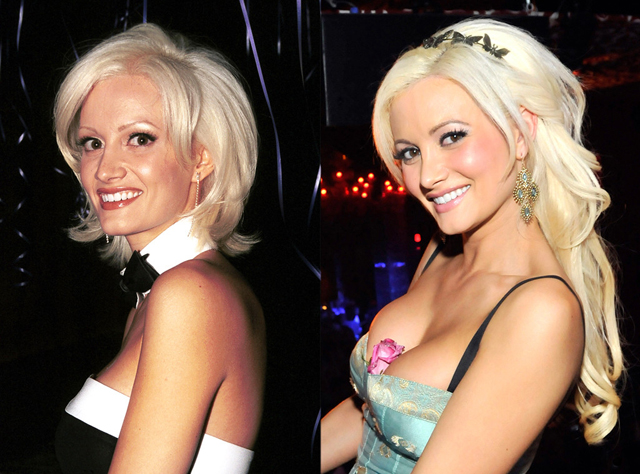 Holly Madison Breast Implants