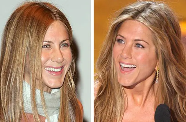 Jennifer Aniston Nose Job Plastic Surgery Before and After