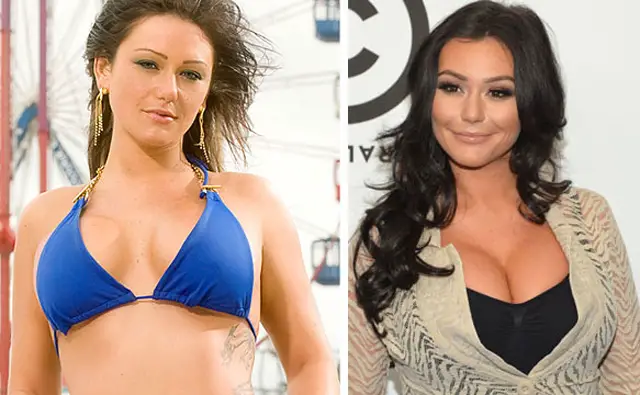 JWoww Breast Implants Plastic Surgery Before and After