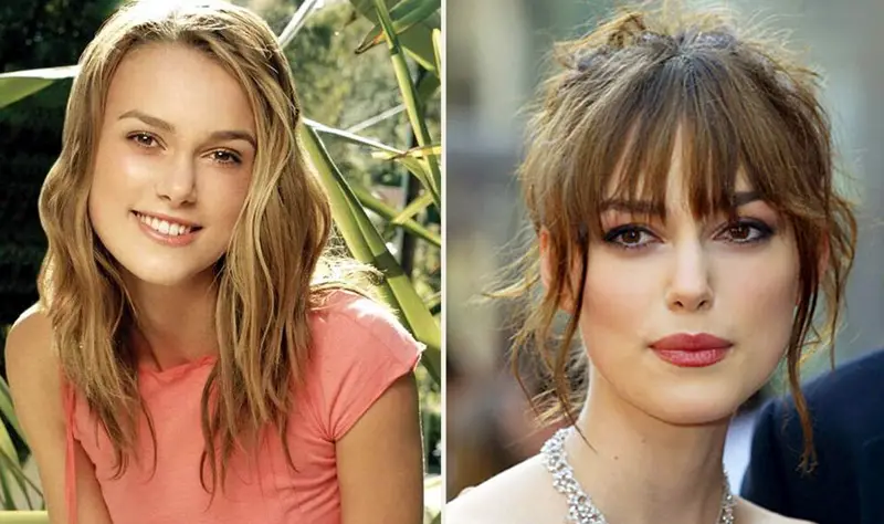 Keira Knightley Nose Job Plastic Surgery Before and After