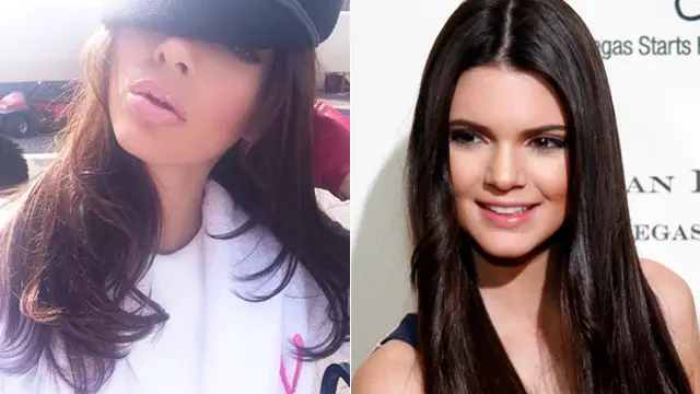 Kendall Jenner Nose Job Plastic Surgery Before and After