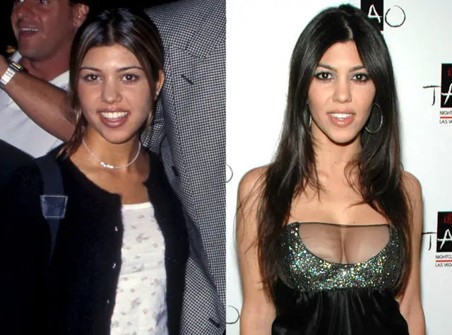 Kourtney Kardashian Breast Implants Plastic Surgery Before and After