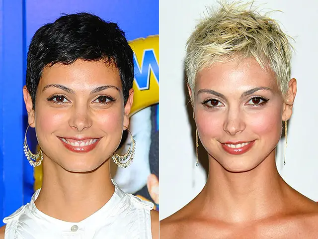 Morena Baccarin Nose Job Plastic Surgery Before and After