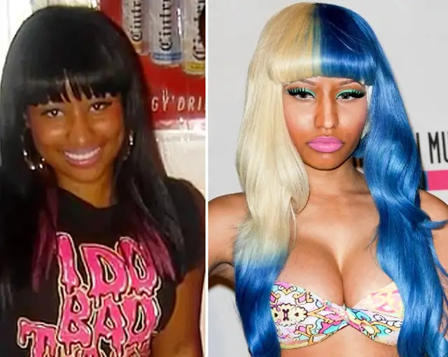 Nicki Minaj Nose Job Plastic Surgery Before and After