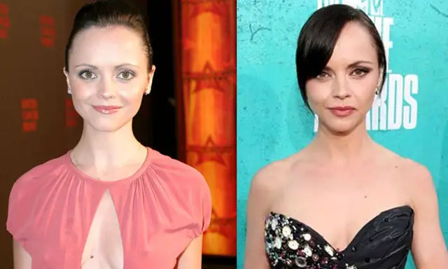 Christina Ricci Nose Job Plastic Surgery Before and After