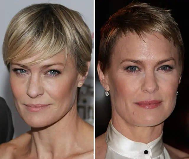 Robin Wright Plastic Surgery Before and After Botox