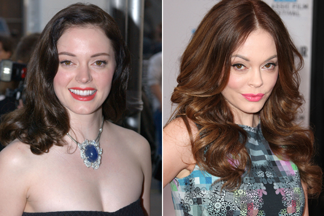 Rose McGowan Nose Job Plastic Surgery Before and After