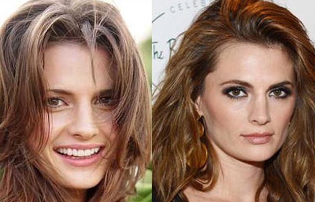 Stana Katic Nose Job Plastic Surgery Before and After