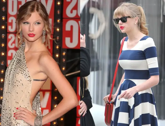 Taylor Swift Surgery Before and After
