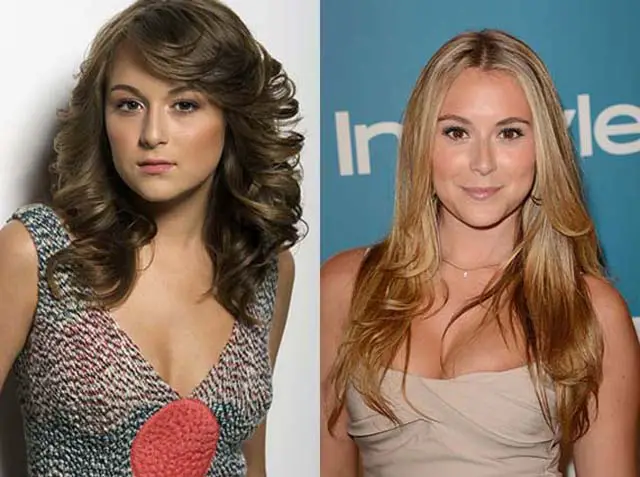 Alexa Vega Breast Implants Plastic Surgery Before and After