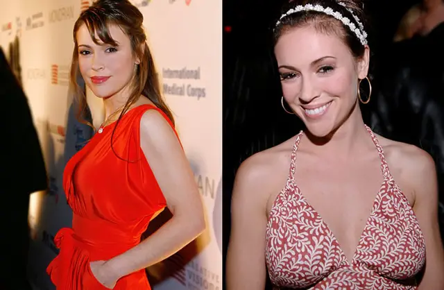 Alyssa Milano Plastic Surgery Before and After 