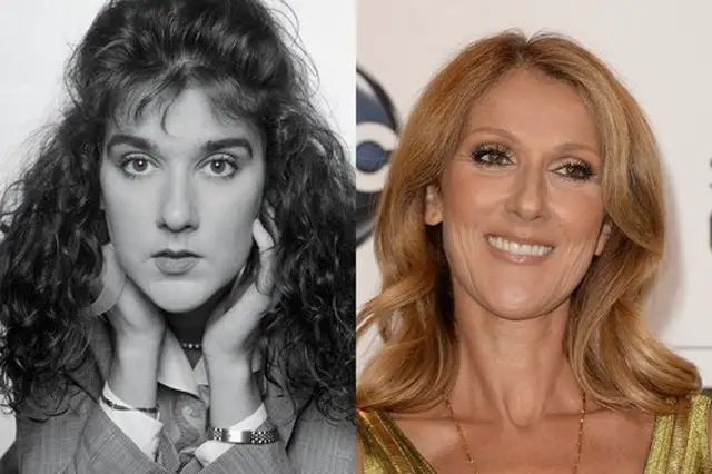 Celine Dion Nose Job Plastic Surgery Before and After