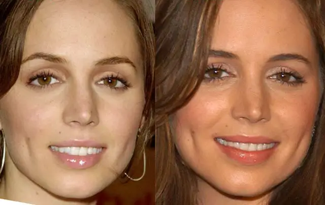 Eliza Dushku Nose Job Plastic Surgery Before and After
