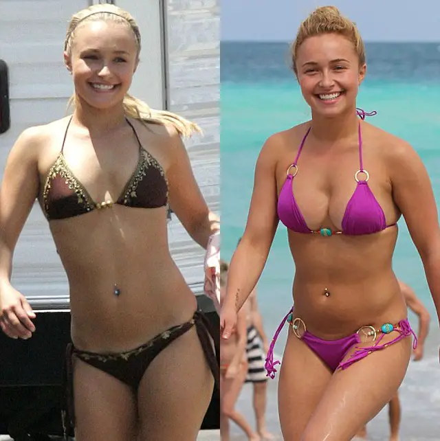 Hayden Panettiere Breast Implants Plastic Surgery Before and After