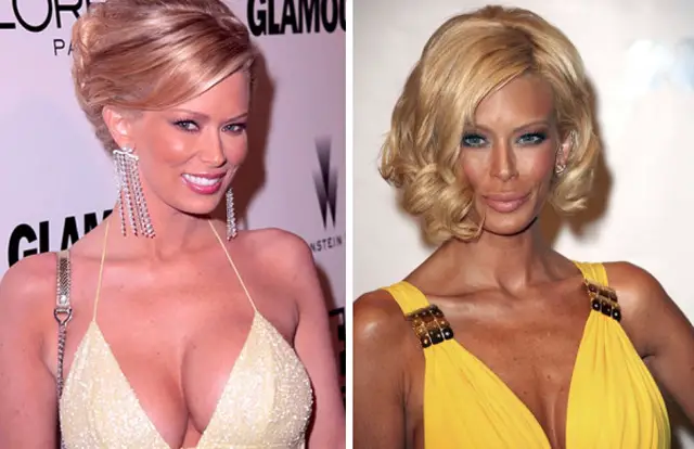 Jenna Jameson Breast Reduction Surgery Before and After