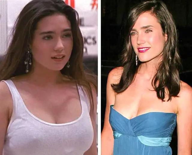 Jennifer Connelly Breast Reduction Plastic Surgery Before and After