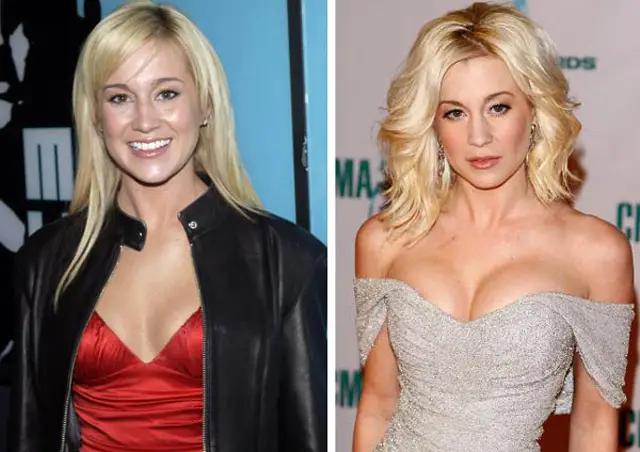 Kellie Pickler Breast Implants Plastic Surgery Before and After