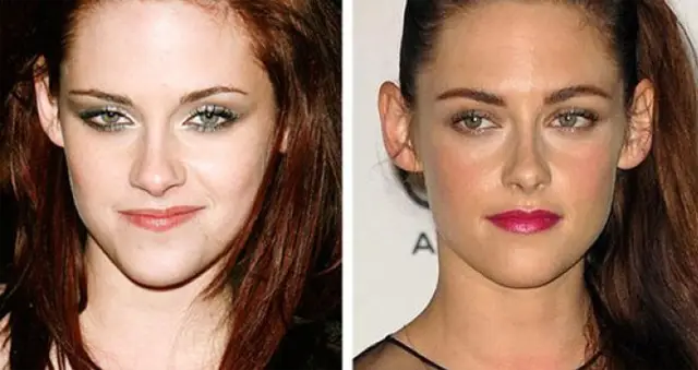 Kristen Stewart Nose Job Plastic Surgery Before and After