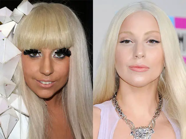 Lady Gaga Nose Job Plastic Surgery Before and After