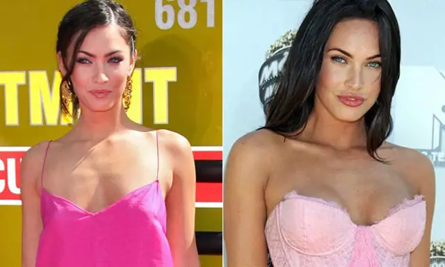 Megan Fox Breast Implants Plastic Surgery Before and After