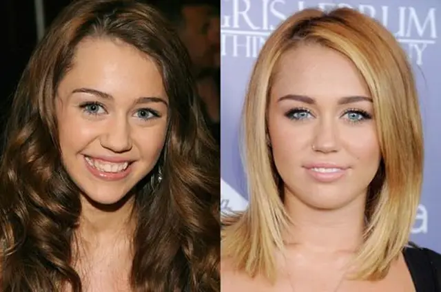 Miley Cyrus Nose Job Plastic Surgery Before and After