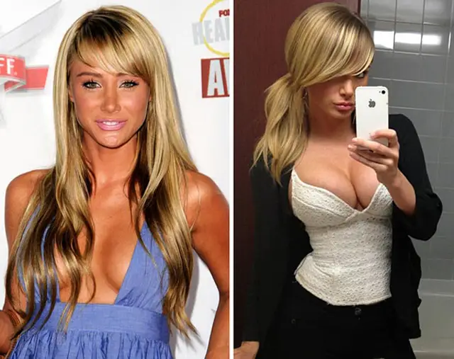 Sara Jean Underwood Breast Implants Plastic Surgery Before and After.