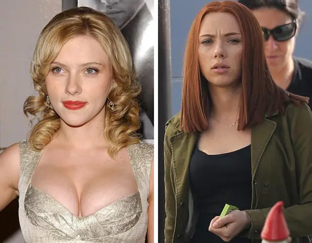 Scarlett Johansson Breast Reduction Plastic Surgery Before and After