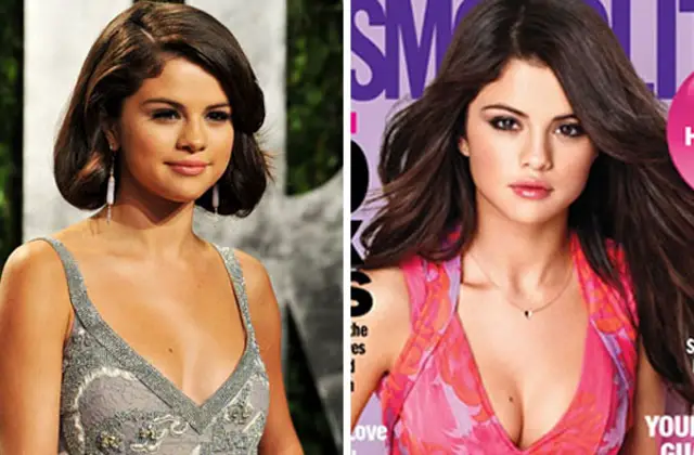 Selena Gomez Breast Implants Plastic Surgery Before and After