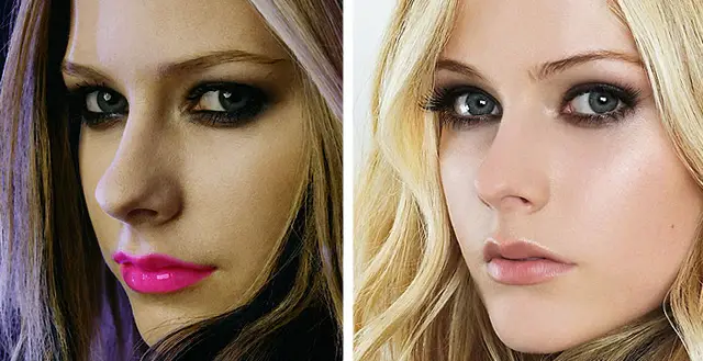 Avril Lavigne Nose Job Plastic Surgery Before and After