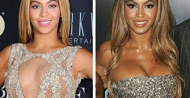 Beyonce Breast Implants Plastic Surgery Before and After