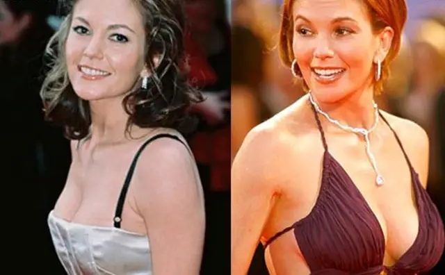 Diane Lane Breast Implants Plastic Surgery Before and After