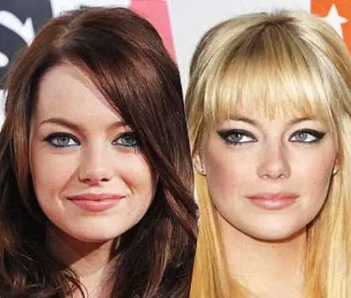 Emma Stone Nose Job Plastic Surgery Before and After