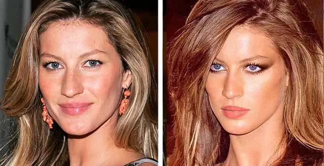 Gisele Bundchen Nose Job Plastic Surgery Before and After