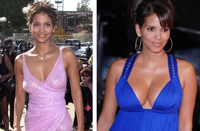 Halle Berry Breast Implants Plastic Surgery Before and After
