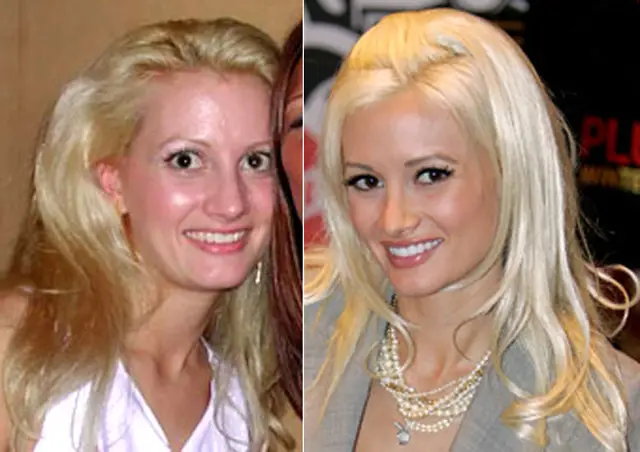 Holly Madison Nose Job Plastic Surgery Before and After
