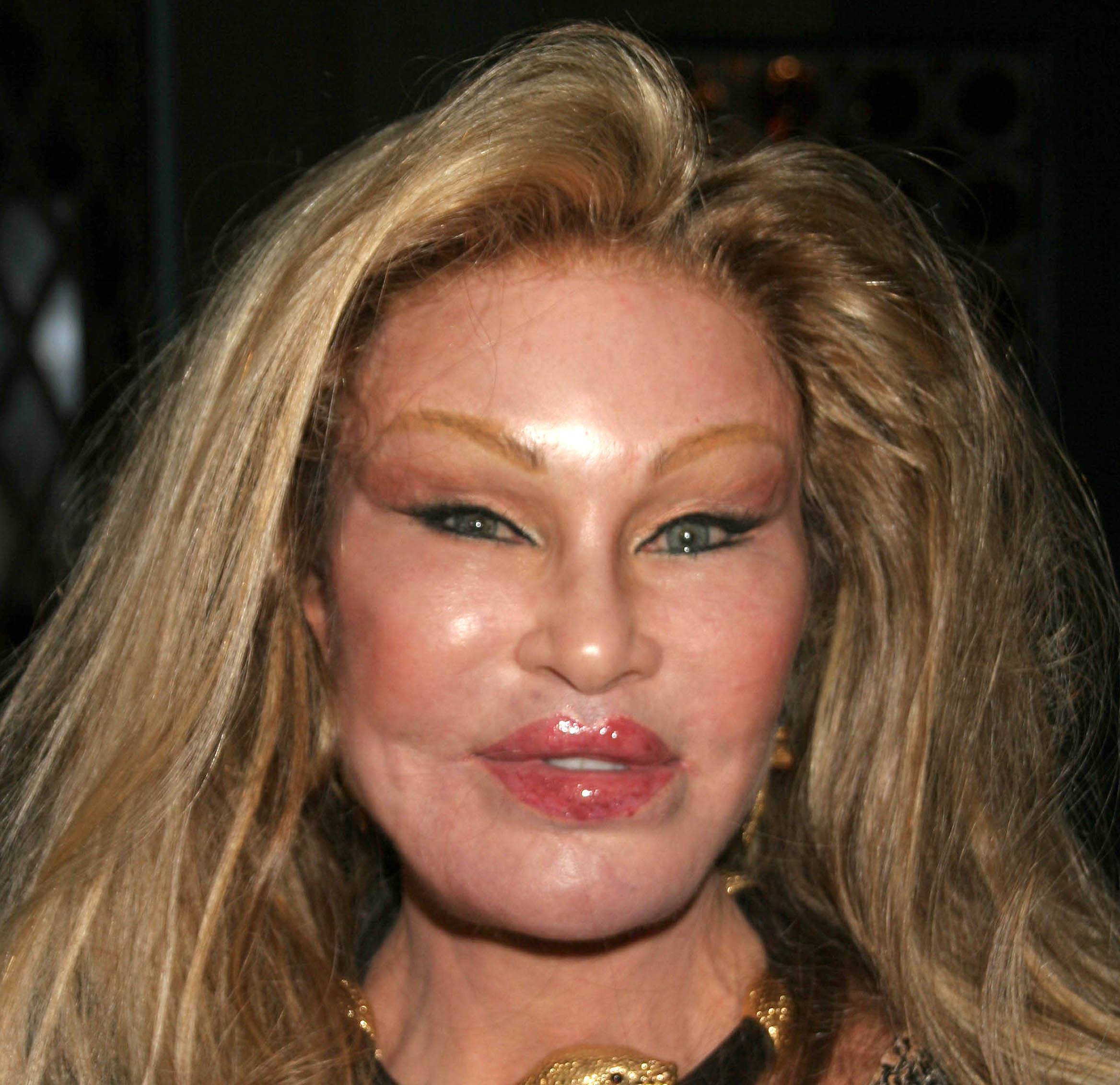 Jocelyn Wildenstein Plastic Surgery Before and After Celebie