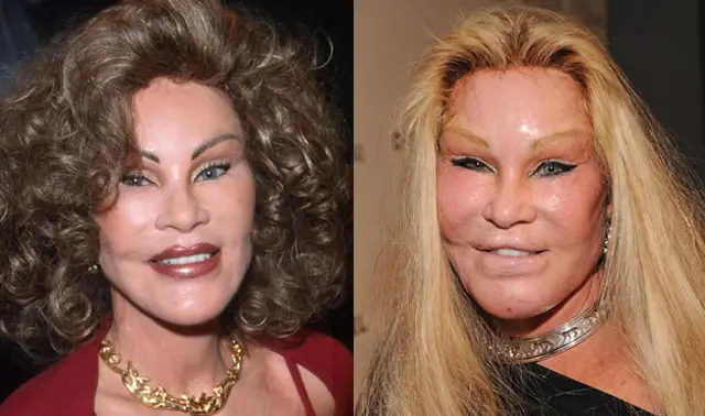 Jocelyn Wildenstein Plastic Surgery Before and After